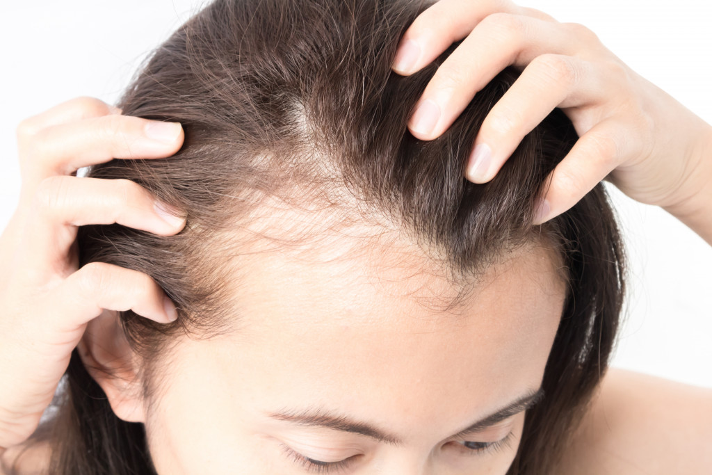 A woman experiencing receding hairline